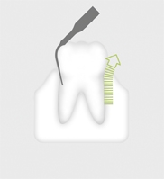 W&H Piezo Tip 1P W&H Piezo Tip 1P